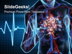 Heartattack Medical PowerPoint Template 1110