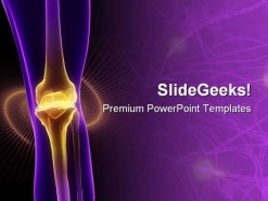 Knee Joint Pain Medical PowerPoint Template 0910